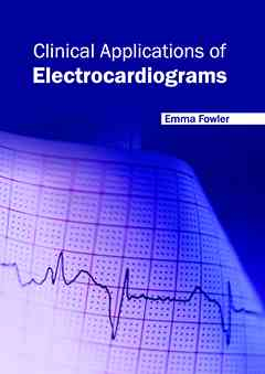 Clinical Applications of Electrocardiograms