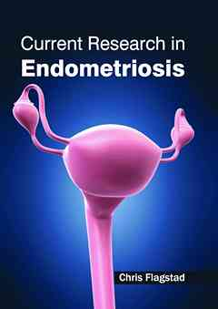 Current Research in Endometriosis