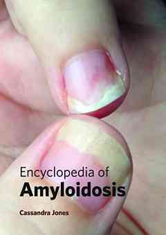 Encyclopedia of Amyloidosis