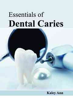 Essentials of Dental Caries