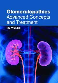 Glomerulopathies: Advanced Concepts and Treatment