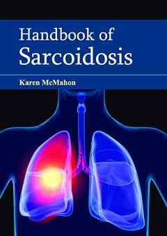 Handbook of Sarcoidosis