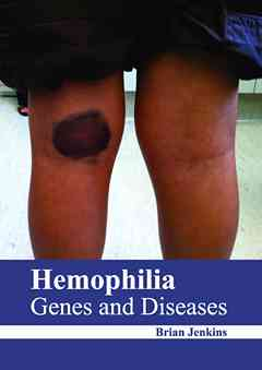 Hemophilia: Genes and Diseases