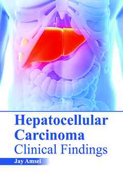 Hepatocellular Carcinoma: Clinical Findings