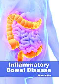 Inflammatory Bowel Disease
