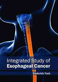 Integrated Study of Esophageal Cancer