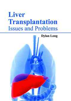 Liver Transplantation: Issues and Problems
