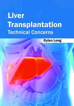 Liver Transplantation: Technical Concerns