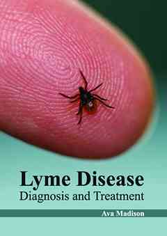 Lyme Disease: Diagnosis and Treatment