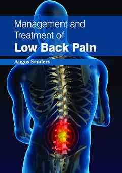 Management and Treatment of Low Back Pain