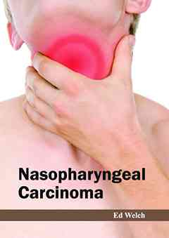 Nasopharyngeal Carcinoma