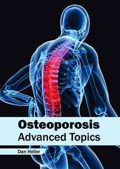 Osteoporosis: Advanced Topics