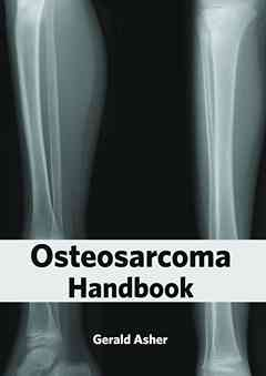 Osteosarcoma Handbook