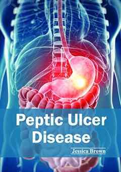 Peptic Ulcer Disease