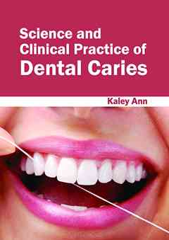Science and Clinical Practice of Dental Caries