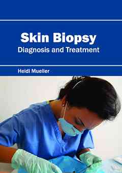 Skin Biopsy: Diagnosis and Treatment