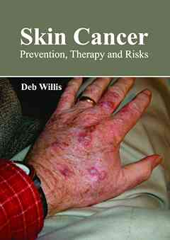 Skin Cancer: Prevention, Therapy and Risks