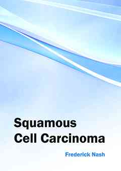 Squamous Cell Carcinoma