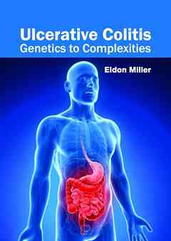 Ulcerative Colitis: Genetics to Complexities