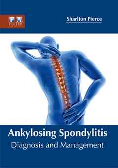Ankylosing Spondylitis: Diagnosis and Management
