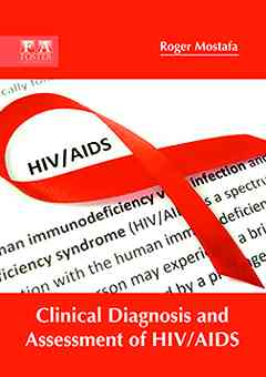 Clinical Diagnosis and Assessment of Hiv/AIDS