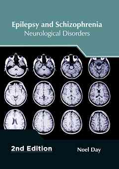 Epilepsy and Schizophrenia: Neurological Disorders