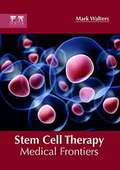 Stem Cell Therapy: Medical Frontiers