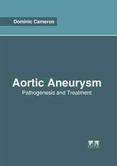 Aortic Aneurysm: Pathogenesis and Treatment