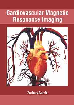 Cardiovascular Magnetic Resonance Imaging