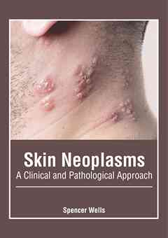 Skin Neoplasms: A Clinical and Pathological Approach