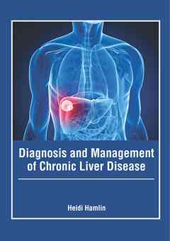 Diagnosis and Management of Chronic Liver Disease