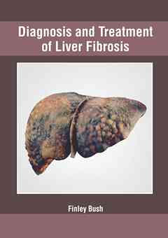 Diagnosis and Treatment of Liver Fibrosis