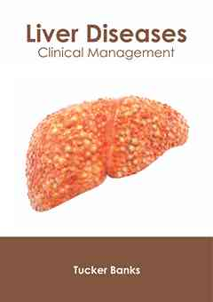 Liver Diseases: Clinical Management