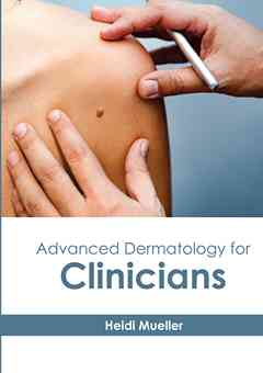 Advanced Dermatology for Clinicians