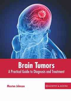 Brain Tumors: A Practical Guide to Diagnosis and Treatment