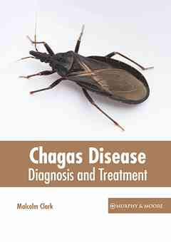 Chagas Disease: Diagnosis and Treatment