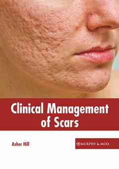 Clinical Management of Scars