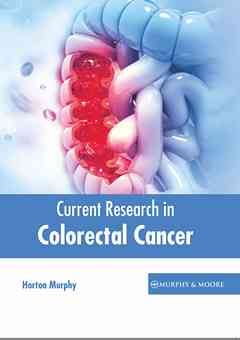 Current Research in Colorectal Cancer