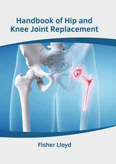 Handbook of Hip and Knee Joint Replacement