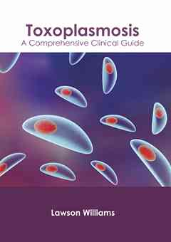 Toxoplasmosis: A Comprehensive Clinical Guide