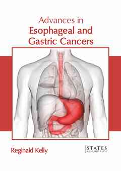 Advances in Esophageal and Gastric Cancers