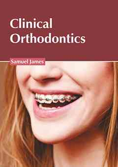 Clinical Orthodontics