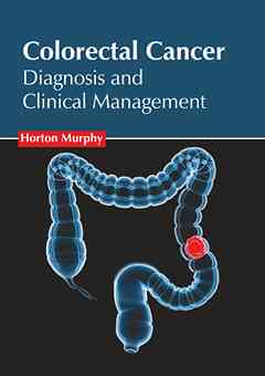 Colorectal Cancer: Diagnosis and Clinical Management
