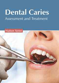 Dental Caries: Assessment and Treatment