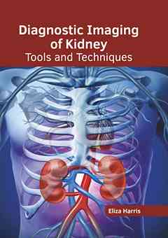 Diagnostic Imaging of Kidney: Tools and Techniques