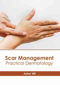 Scar Management: Practical Dermatology