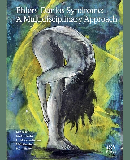 Ehlers-Danlos Syndrome: A Multidisciplinary Approach, 1st Edition
