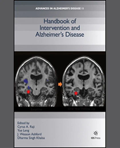 Handbook of Intervention and Alzheimer’s Disease, 1st Edition