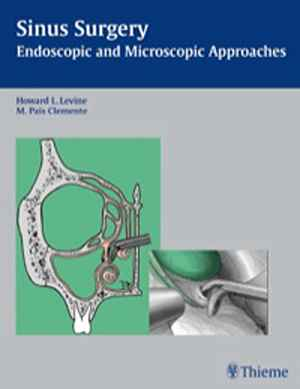 Sinus Surgery: Endoscopic and Microscopic Approaches