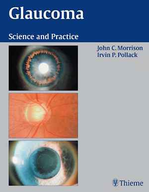 Glaucoma: Science and Practice  1st